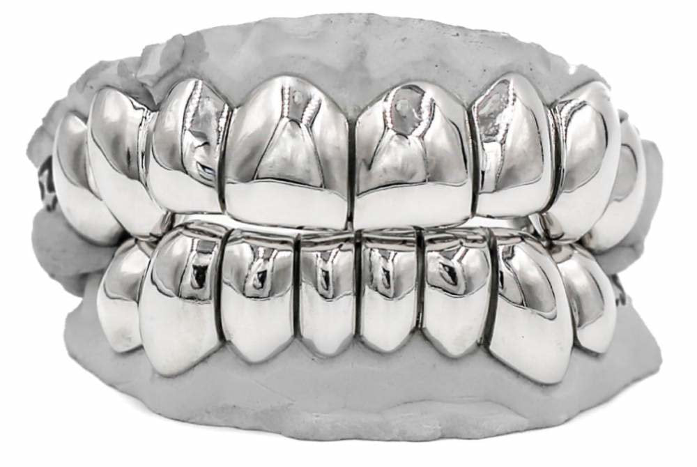 Solid Gold Diamond Grillz